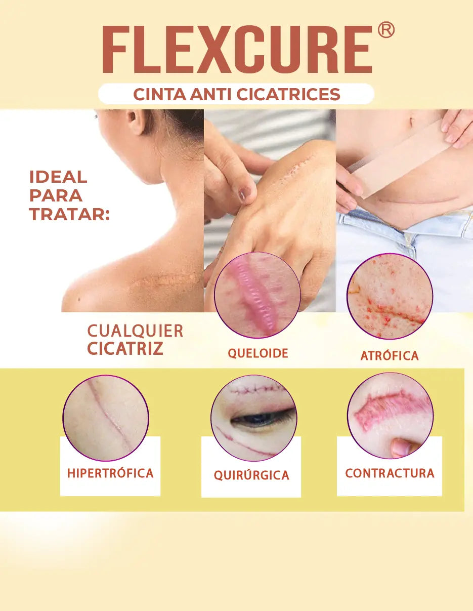 CINTA ANTI CICATRICES FLEXCURE [PV1-TIKTOK-IMPORTSGUATE]