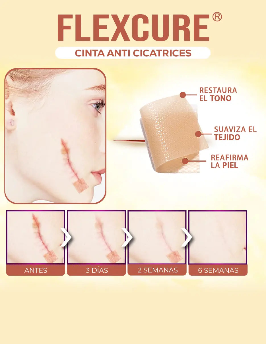 CINTA ANTI CICATRICES FLEXCURE [PV1-TIKTOK-IMPORTSGUATE]