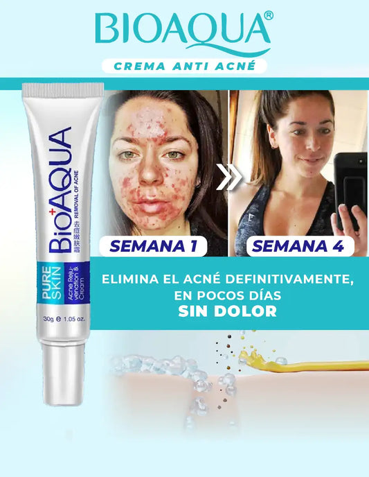 CREMA ANTI ACNE BIOAQUA [PV1-TIKTOK-IMPORTSGUATE]
