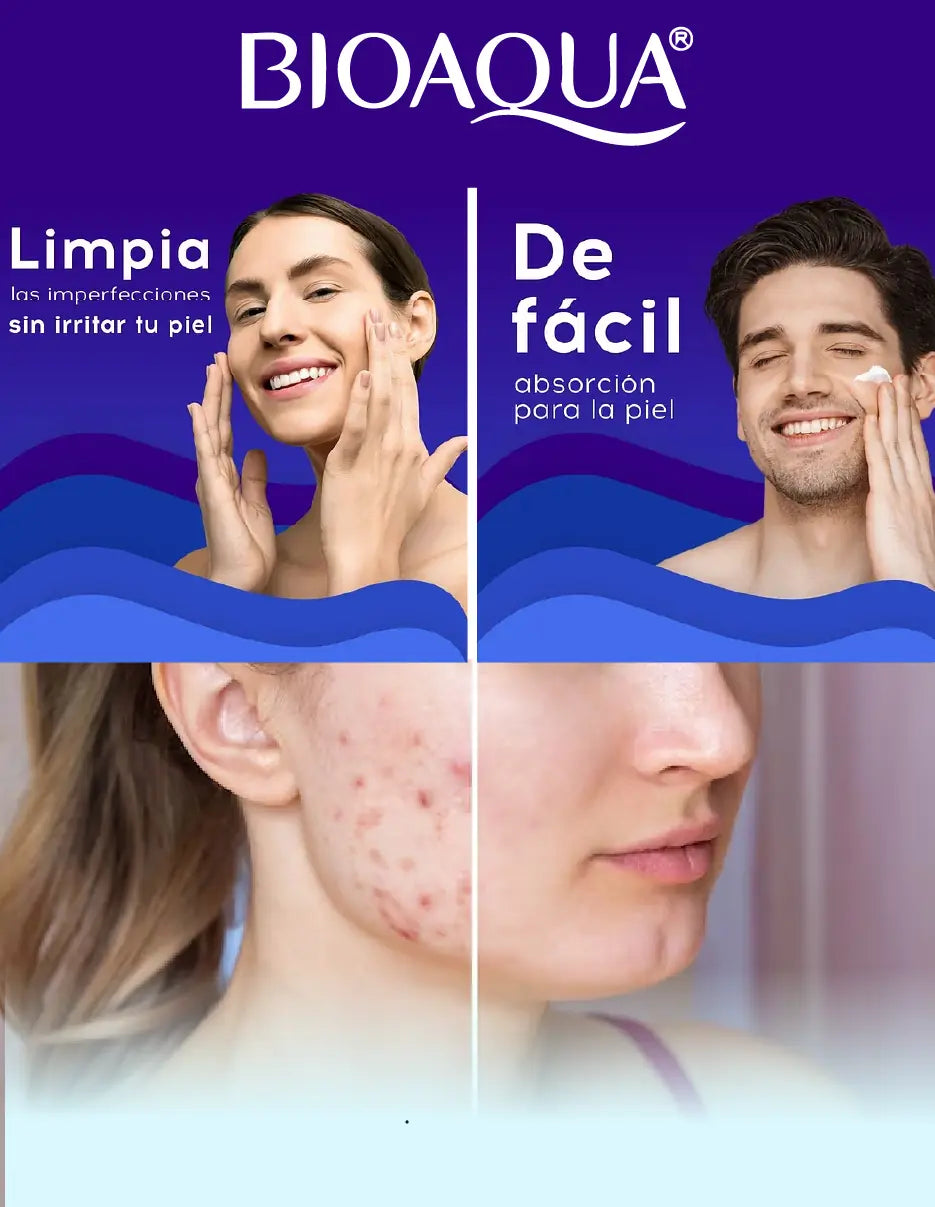 CREMA ANTI ACNE BIOAQUA [PV1-TIKTOK-IMPORTSGUATE]