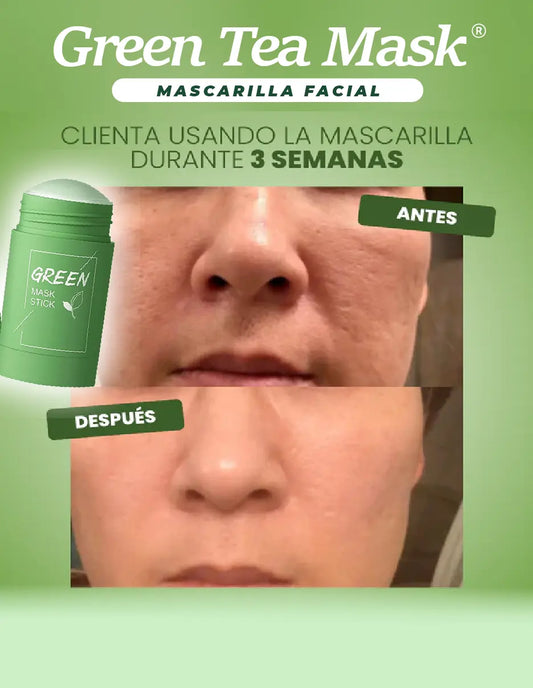 GREEN TEA MASK [PV1-TIKTOK-IMPORTSGUATE]