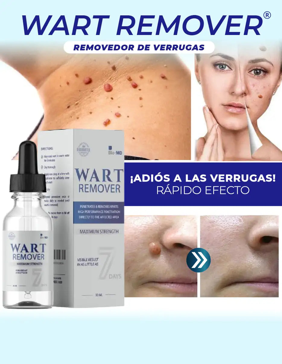 REMOVEDOR DE VERRUGAS WART REMOVER [PV1-TIKTOK-IMPORTSGUATE]