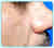 After Image